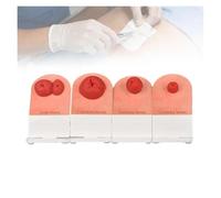 4pcs Ostomy Care Training Model, Realistic Fistula & Ileostomy Care Teaching Manikin，Stoma Nursing Simulator Wound Care for Medical Student Practice