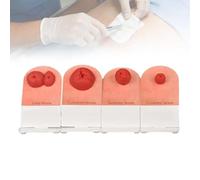 4pcs Ostomy Care Training Model, Stoma Nursing Simulator Wound Care Models for Medical Student Practice, Realistic Fistula & Ileostomy Care Teaching Manikin