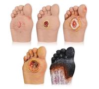 5 Pcs Diabetic Foot Care Model - Grade 1-5 Diabetic Foot Nursing Simulator Model, Human Foot Model for Anatomy, Physiology, Wound Care Demonstrations Tool