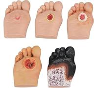 5 Pcs Diabetic Foot Care Model, Grade 1-5 Diabetic Foot Wound Care Demonstrations Model, Pathological Changes of Foot Ulcers Model, for Anatomy, Physiology, Wound Care Demonstrations Tool.