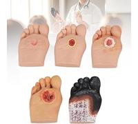 5 PCS Diabetic Foot Ulcer Model - Grade 1-5 Diabetic Foot Nursing Simulator Model, Human Foot Model, Realistic Wound Care Training Tool for Anatomy, Physiology