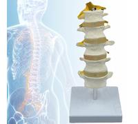5-Segment Lumbar Spine Skeleton Model with Diseased Intervertebral Disc & Transparent Nerve Root - Ideal for Medical Teaching & Anatomy Study