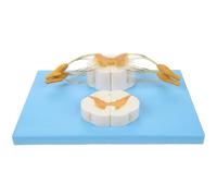 5 Time Magnification Human Nerve Anatomy Model, Spine And Spinal Nerve Branches Model, Spinal Cord And Spinal Nerves Cross Section, for Teaching, Study, Researching Display