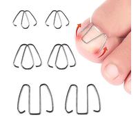 6 Pcs 3 Sizes Ingrown Toenail Wire Toenail Corrector Recover Care Nail Tool Stainless Steel Ingrown Toenail Correction for Ingrown Toenails Care Curve Correct Ingrown Toenail Treatment