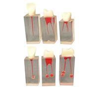 6 Pcs Endodontic Transparent Root Canal Model Dental Resin Root Canal Exercise Block Model for Teaching and Study
