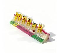 6-Stage Dental Caries Development Model - Anatomical Teeth Decay Demonstration with Color-Coded Labels for Dental Education, Patient Consultation & Teaching (Normal Decay Model)