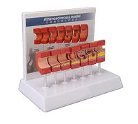 7PCS Artery Anatomy Model Human Body Artery Model Educational Anatomy Models Atherosclerosis Thrombus Vascular Model for Clinic School