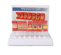 7Piece Artery Anatomy Model Set - Realistic Vascular Replica Demonstrating Atherosclerosis and Thrombus for Medical Education