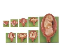 8-Figure Pregnancy Embryo Development Stages with Removable Fetus