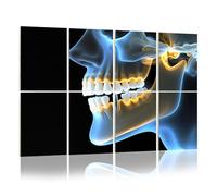 8 Pack Acoustic Foam Panels Sound Proofing medical visualization dental implant jaw rendering Acoustic Wall Panel Soundproofing for Livingroom Nursery Room 120x80cm Home Decor