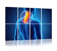8 Pack Acoustic Panels Sound Proofing Neck painful cervica spine skeleton x ray 3D Acoustic Wall Panel Soundproofing for Livingroom Nursery Room 120x80cm Home Decor