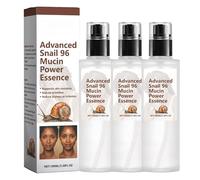 96 Mucin Power Essence 100ml, Skin Repair & Hydrating Serum Secretion Filtrate 96% Skincare Mucin Face Serum Mucin Serum Face Care Skin Repair, Fine Lines Dark Circles Wrinkle Reduction for Dull (3)