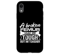 A broken femur may be tough but Im tougher Design Case for iPhone XR