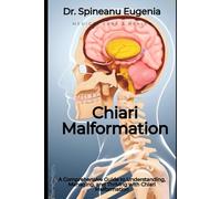 A Comprehensive Guide to Understanding, Managing, and Thriving with Chiari Malformation