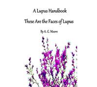 A Lupus Handbook: These Are The Faces Of Lupus