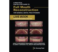 A Practical Step By Step Guide to Full Mouth Reconstruction for General Dental Practitioners: How to Progress From Single Tooth Dentistry To Direct Adhesive Full Mouth Reconstruction
