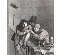 A surgeon operates on a patient's arm in the 17th century. Following a later copy of a 17th century work by Marinus Robyn van der Goes. Poster Print by Ken Welsh (13 x 15)