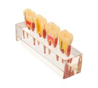 ABOOFAN Removable Pediatric Dental Model with Caries Progression Visualization Deciduous Teeth Educational Teaching Aid for Dental Students Oral Health Endodontic Treatment Demo