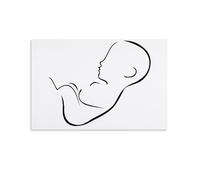 Abstract Drawing of Fetus Minimalistic Abstract Art Poster Canvas Wall Art Painting Office Home Decor Gifts 16x24inch(40x60cm)