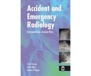 Accident and Emergency Radiology: X Ray Interpretation