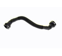 ACKOJA Aftermarket Radiator Hose High Quality for HYUNDAI A52-0667