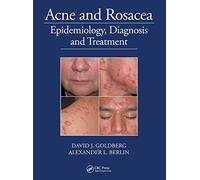 Acne and Rosacea: Epidemiology, Diagnosis and Treatment