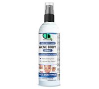 Acne Body Spray for Face & Body - Clear Skin Treatment, Reduces Acne Breakouts, Soothes Irritation - Fast Absorbing & Non-Greasy Formula - Men & Women (250ml Spray)