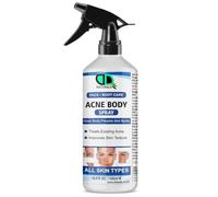 Acne Body Spray for Face & Body - Clear Skin Treatment, Reduces Acne Breakouts, Soothes Irritation - Fast Absorbing & Non-Greasy Formula - Men & Women (500ml Spray)
