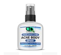 Acne Body Spray for Face & Body - Clear Skin Treatment, Reduces Acne Breakouts, Soothes Irritation - Fast Absorbing & Non-Greasy Formula - Men & Women (30ml Spray)