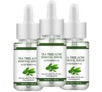 Acne-fighting facial serum, herbal acne-fighting facial serum, balances skin, moisturizes, and tightens pores. Suitable for all skin types.