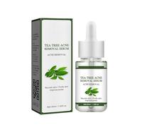 Acne Removing Facial Serum, Natural Ingredients Professionally Remove Acne Marks, Remover Pimple and Repair Skin, Moisturizer & Fine pores for Teens & Adults (1pc)