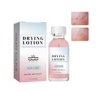 Acnecide Anti-Acne Treatment Serum - Drying Lotion for Face & Body, Fast-Acting Pimple Treatment to Dry Out Spots, Reduce Blemishes & Redness, Acne Spot Treatment for Teens, Women & Men (30ml)