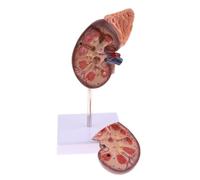 Acouto Kidney Model Ana Normal Human Anatomical Teaching Doctors Office Educational Tool Kidney ModelKidney Model AnatomyTeaching Kidney ModelHuman Kidney ModelHuman Kidney Ana