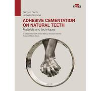 Adhesive cementation on natural teeth. Materials and techniques