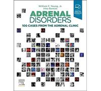 Adrenal Disorders: 100 Cases from the Adrenal Clinic