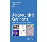 Adrenocortical Carcinoma: Basic Science and Clinical Concepts