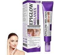 Advanced Anti-Hyperpigmentation Cream, Dark Spot Remover for Face and Body, For Hyperpigmentation Treatment, Dark Spot and Melasma Treatment