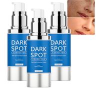 Advanced Dark Spot Corrector Serum with Niacinamide, Retinol & Hyaluronic Acid, Age Spot Reducer for Face and Body | Fades Sun Spots, Freckles, Improves Skin Tone | All Skin Types (3PCS)