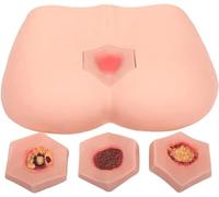 Advanced Stage 4 Bedsore Training Model for Nursing Education, Anatomical Decubitus Ulcer Demonstration Tool for Wound Care Training at Home or School