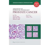Advances in Surgical Pathology: Prostate Cancer
