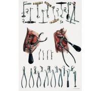 Affiche Prints ML21 Vintage 1800's Medical Dentist Tooth Extraction Dental Tools & Equipment Anatomical Anatomy Poster Re-Print - A2+ (610 x 432mm) 24" x 17"
