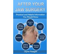 After Your Jaw Surgery: Practical and Helpful Information You Should Know