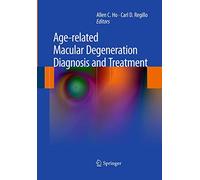 Age-related Macular Degeneration Diagnosis and Treatment