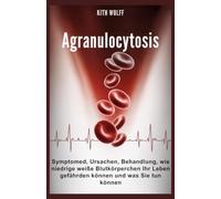Agranulocytosis: Symptome, Ursachen, Behandlung, wie niedrige weiße Blutkörperchen Ihr Leben gefährden können und was Sie tun können