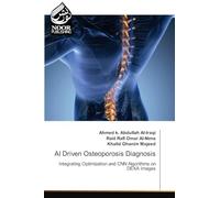 AI Driven Osteoporosis Diagnosis