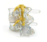 Akfldms Human Vertebrae Skeleton Human Anatomical Model Anatomy Degenerative Lumbar Disc Herniation Demonstration Spine Medical Aid