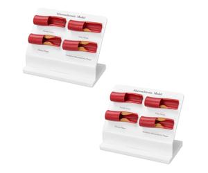 Akfldms Plaque-Artery Vascular Model Human Atherosclerosis Four-Stage for Anatomy Education 2pcs Disease