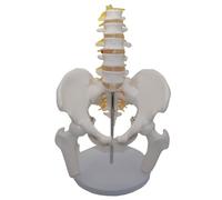 Akfldms Teaching Equipment Plastic Bone Model of Umbar Vertebrae with Pelvic and Fractured Leg Nerves Human Body