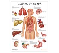 Alcohol and The Body Chart/Poster, 45x60cm, 18x24 inches, Human Anatomy, Anatomical Poster for Education Learning and Students, Alcohol Effects on The Human Body, Pathology Poster