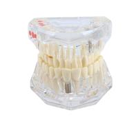 Alide Typodont Teeth Model, Standard Transparent Dental Model with Implants & Removable Teeth, Tooth Pathological Teaching for Anatomy Demonstration